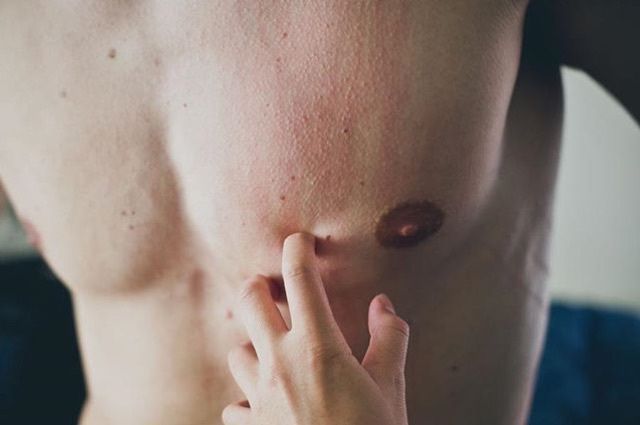 chest